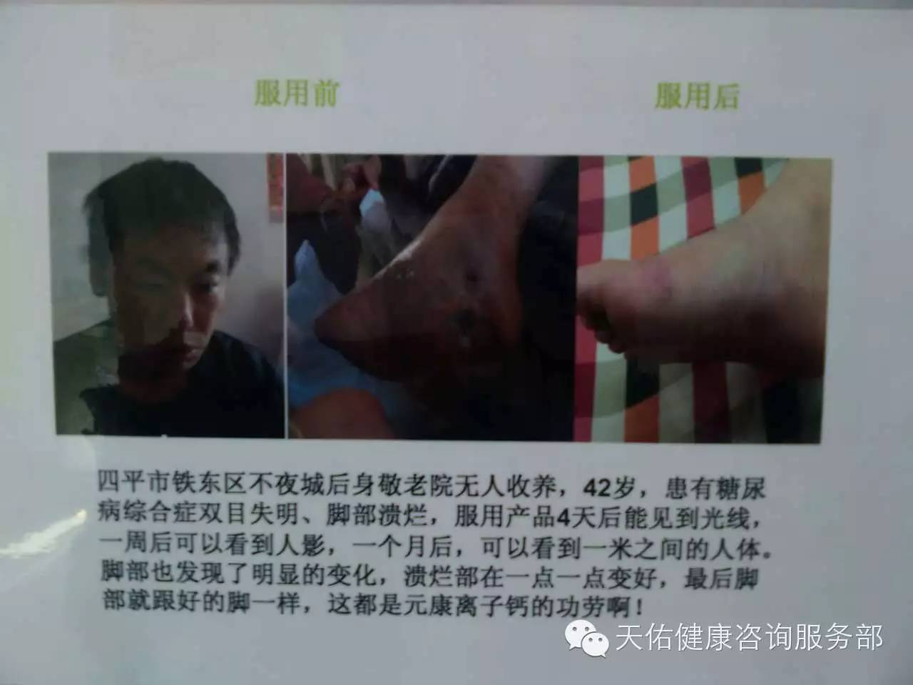 补硒补多少钱一盒（补硒补多少钱一盒）-硒宝网