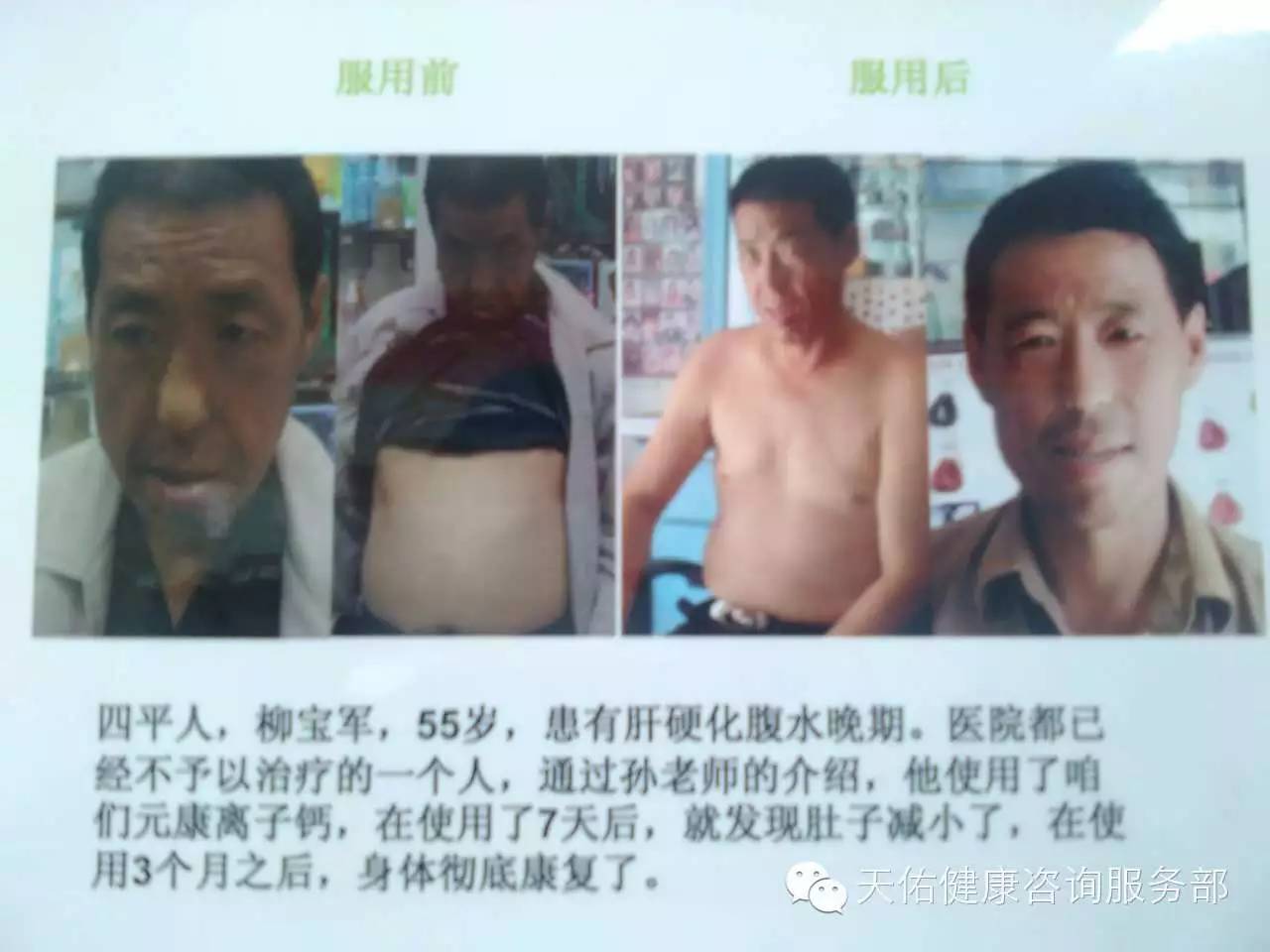 补硒补多少钱一盒（补硒补多少钱一盒）-硒宝网