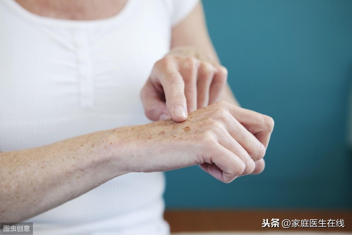 补硒能去老年斑吗（补硒能淡化色斑吗）-硒宝网