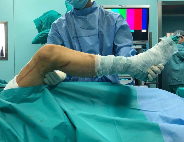 补硒能不能长寿呢(补硒有什么好处能长期服用)-硒宝网