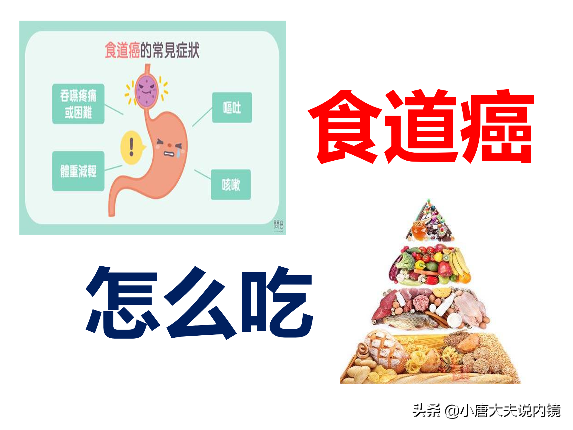 食道癌补硒能好吗（癌症患者可以吃硒吗）-硒宝网