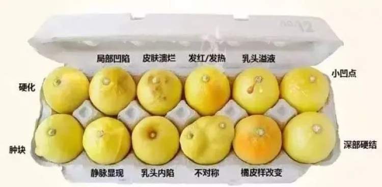 乳腺癌补什么硒好(乳腺癌补硒一天用量是多少)-硒宝网