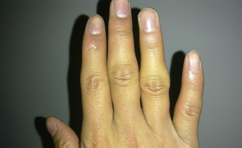 缺硒吃什么药能补（缺硒的药物）-硒宝网