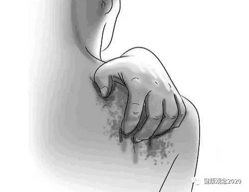 牛皮癣用什么补硒(全民补硒)-硒宝网