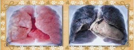 有哪些人不能补硒(补硒会致癌吗)-硒宝网