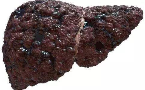 肝病还要不要补硒(肝病补硒)-硒宝网