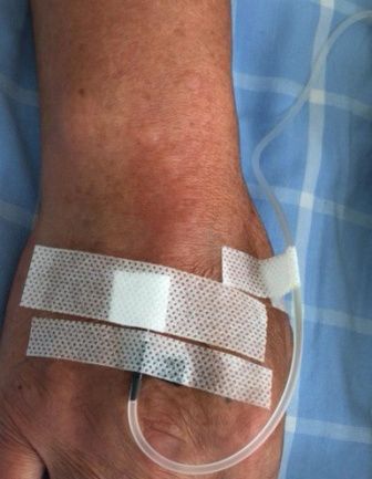 麦芽硒一天补多少(补麦芽一天硒含量多少)-硒宝网