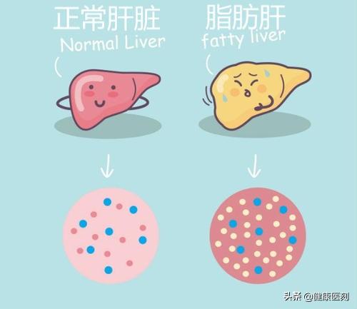 胆结石病人补硒吗(胆结石可以补硒吗)-硒宝网