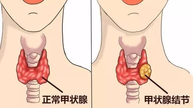 甲亢能补硒和镁吗(镁能补甲亢硒吗)-硒宝网