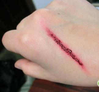 补硒后身体重减轻(补硒会变胖吗)-硒宝网