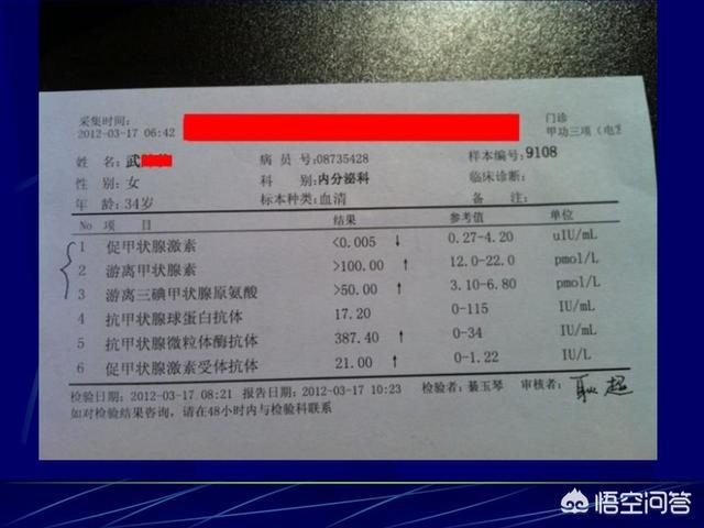 桥本甲减需补硒吗(桥本甲减要吃硒酵母吗)-硒宝网