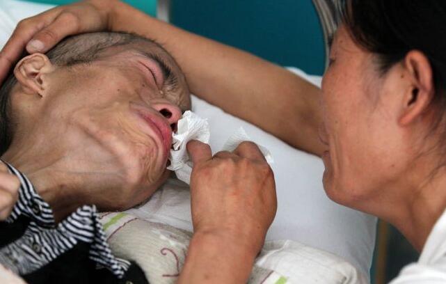 补硒后身体重减轻(补硒后身体的调整反应)-硒宝网