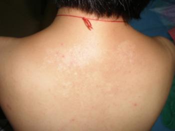 白癜风能不能补硒（新硒望科学补硒协会）-硒宝网