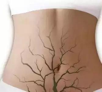 补硒会睡不着觉吗（补硒对睡眠有好处吗）-硒宝网