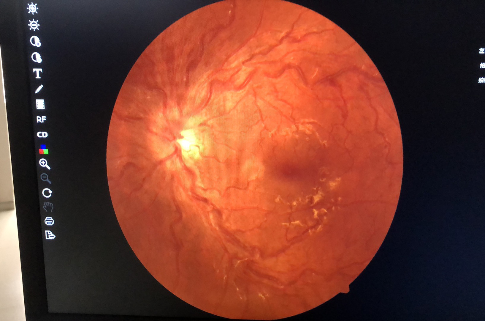 补硒吃鹅蛋可以吗(鹅蛋硒元素的含量多少)-硒宝网