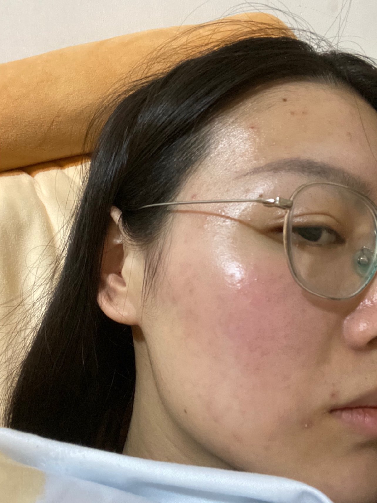 补硒能减少长痘吗(长痘可以补充什么维生素)-硒宝网