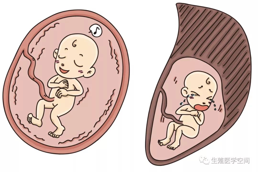 甲亢要补碘跟硒么（甲亢硒要补碘吗为什么）-硒宝网