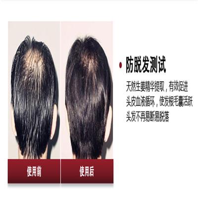 补硒以后掉头发吗（补硒脱发是什么原因引起的）-硒宝网