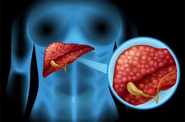 肝病患者补多少硒（补患者肝病硒片能吃吗）-硒宝网