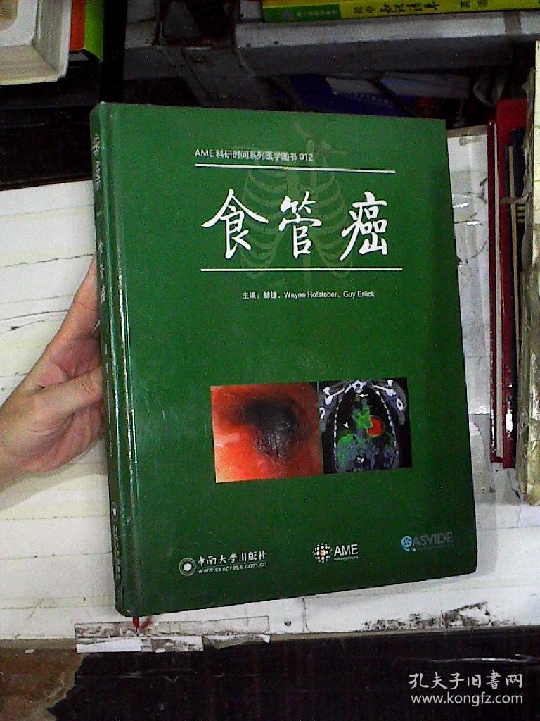 食道癌大剂量补硒（食道癌补硒能好吗）-硒宝网