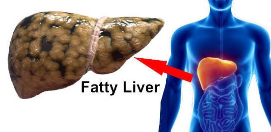 脂肪肝补硒的药物(肝脂肪药物补硒有用吗)-硒宝网