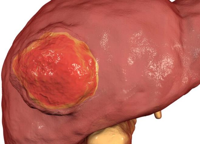 乙肝携带者能补硒(乙肝患者可以补硒吗)-硒宝网