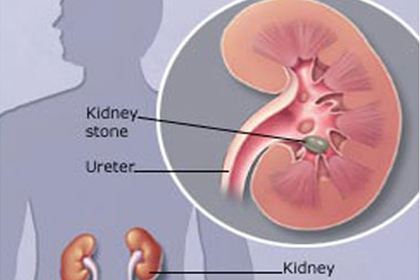 肾切除后能补硒吗（肾切除能补硒后吃什么）-硒宝网