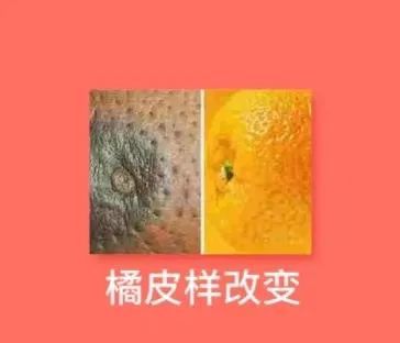 补硒能防卵巢癌吗（硒对卵巢癌有作用吗）-硒宝网