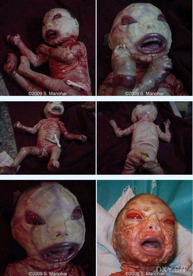 补硒怎么治扁平疣(扁平疣吃硒元素管用吗)-硒宝网