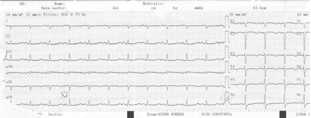 扩张型心肌病补硒（扩张型心肌病新药）-硒宝网