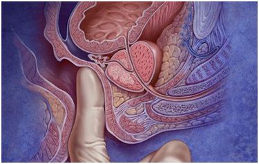 糖尿病胆囊癌补硒(胆囊癌补硒可以嘛)-硒宝网