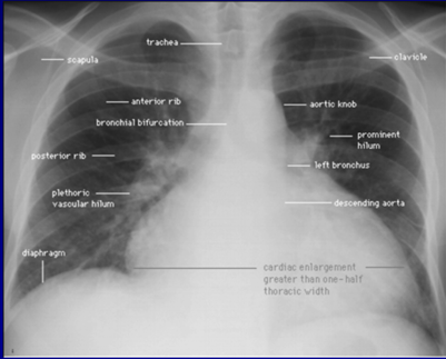 扩张型心肌病补硒(扩张病补心肌型硒有用吗)-硒宝网