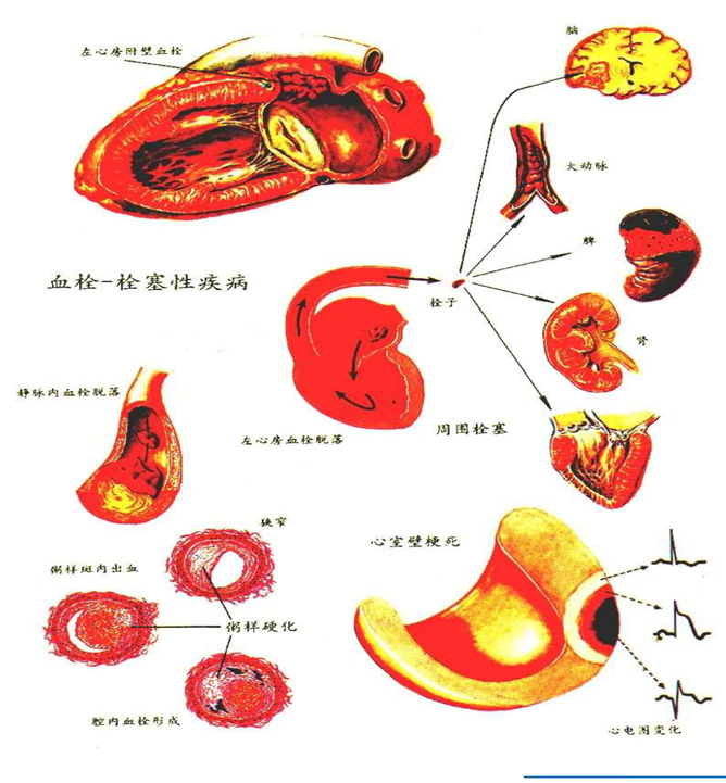 扩张型心肌病补硒(扩张病补心肌型硒有用吗)-硒宝网