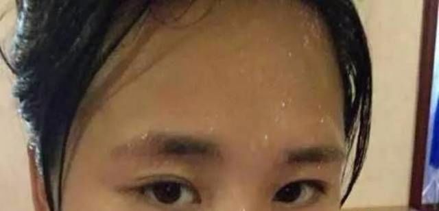 预兆中风大量补硒(预兆中风补大量硒好吗)-硒宝网