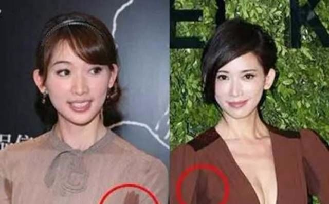 预兆中风大量补硒(预兆中风补大量硒好吗)-硒宝网