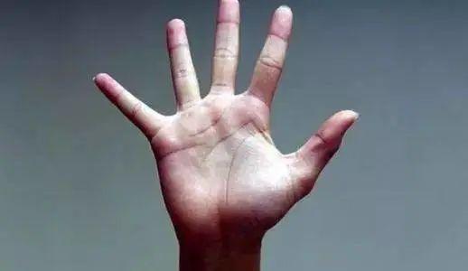 硒麦芽五子粉补肝（肝炎可以吃硒麦芽五味子片吗）-硒宝网