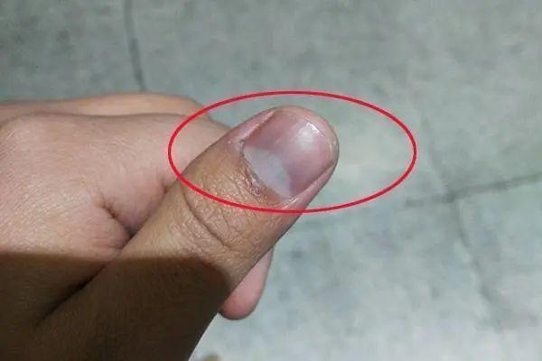 硒麦芽五子粉补肝（肝炎可以吃硒麦芽五味子片吗）-硒宝网