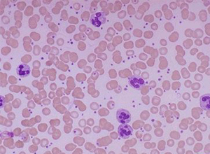 补硒三个月免疫力(补硒增强免疫力)-硒宝网