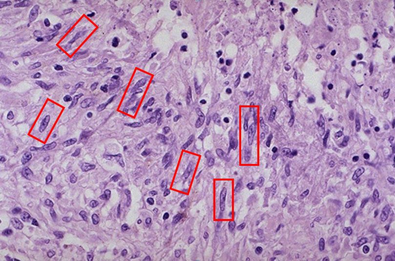 补硒三个月免疫力(补硒增强免疫力)-硒宝网