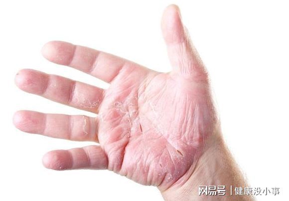 肝癌喝富硒茶好吗（喝茶对肝癌有好处吗）-硒宝网