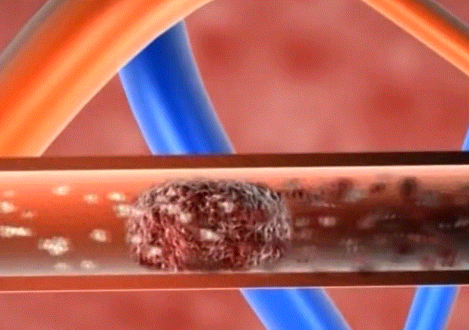 富硒黄金茶的泡法(黄金茶的药效)-硒宝网