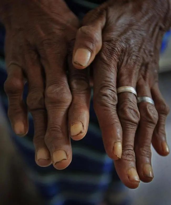 永州富硒大米好吃(富硒大米口感)-硒宝网