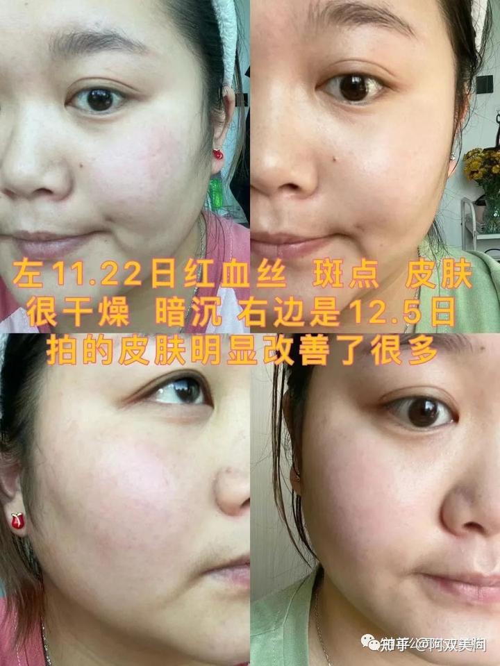 硒硒公主美容产品（硒硒公主护肤品怎么样）-硒宝网