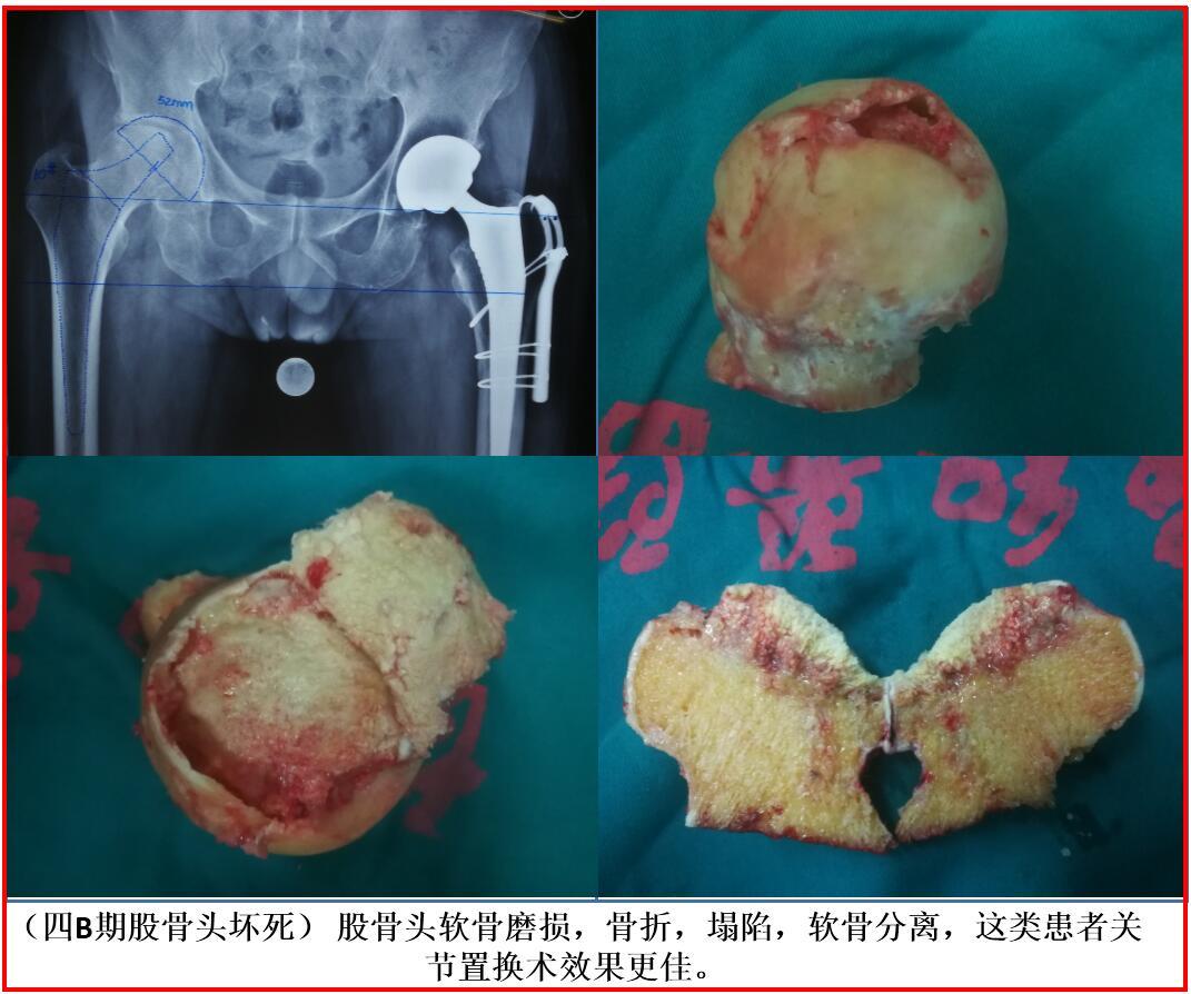 硒产品的销售模式(产品销售模式的类型)-硒宝网