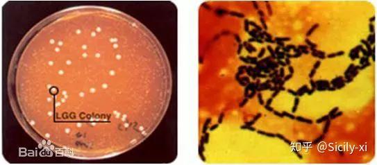 澳洲护眼产品含硒（澳洲补硒元素产品）-硒宝网