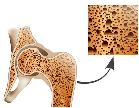 老年人补钙应该吃什么钙最好呢（老人补充钙）-硒宝网