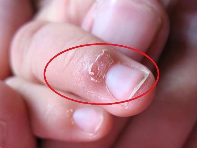 缺乏微量元素怎么补（缺乏微量补元素吃什么）-硒宝网