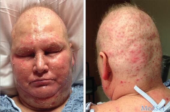 缺乏微量元素怎么补（缺乏微量补元素吃什么）-硒宝网