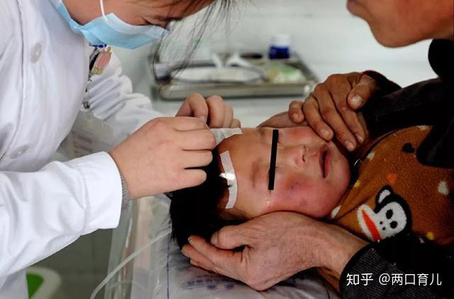 缺乏微量元素怎么补（缺乏微量补元素吃什么）-硒宝网