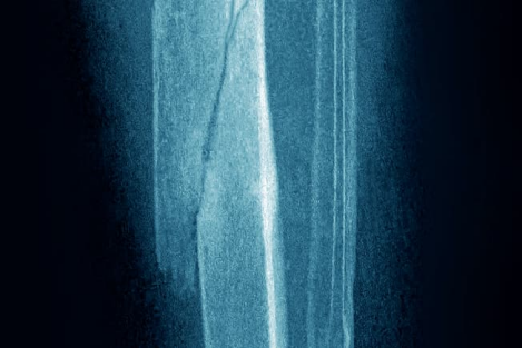 人体需要的微量元素（人体微量元素需要补充吗）-硒宝网